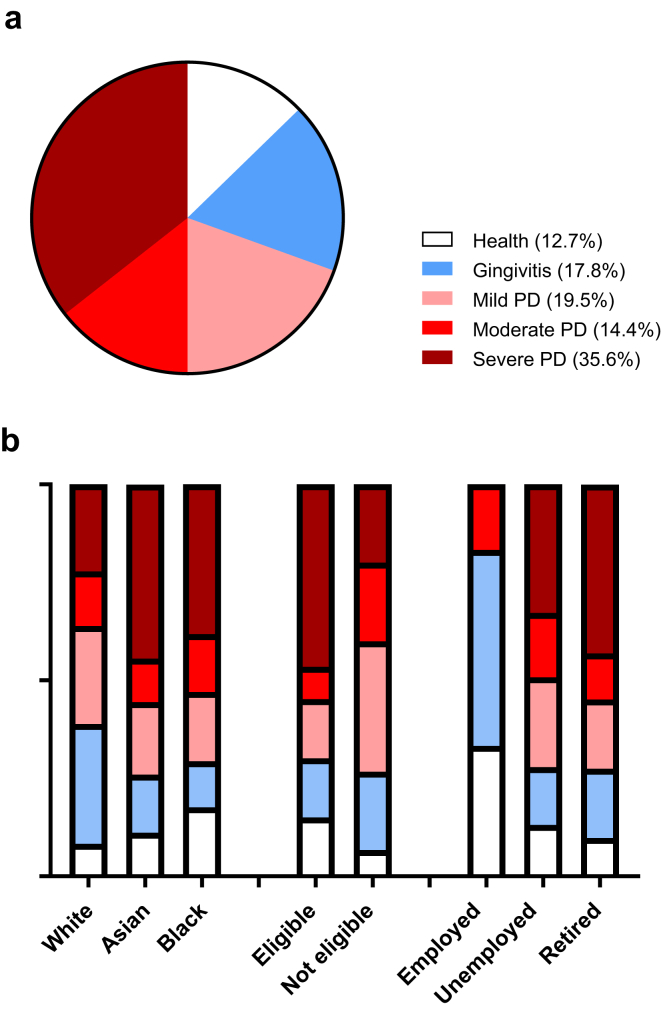 High Prevalence of Periodontal Disease Observed in Patients on Hemodialysis: A Call for Equitable Access to Dental Care