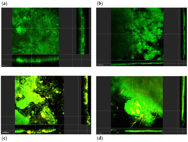 Oral Microcosm Biofilms Grown under Conditions Progressing from Peri-Implant Health, Peri-Implant Mucositis, and Peri-Implantitis