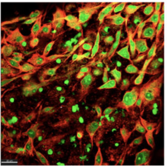 The Effect of Microcosm Biofilm Decontamination on Surface Topography, Chemistry, and Biocompatibility Dynamics of Implant Titanium Surfaces